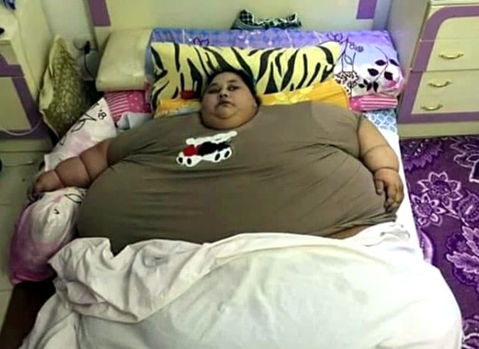 25 yildan beri ostona xatlab ko‘chaga chiqmagan misrlik ayolning vazni 500 kilogrammga yetdi