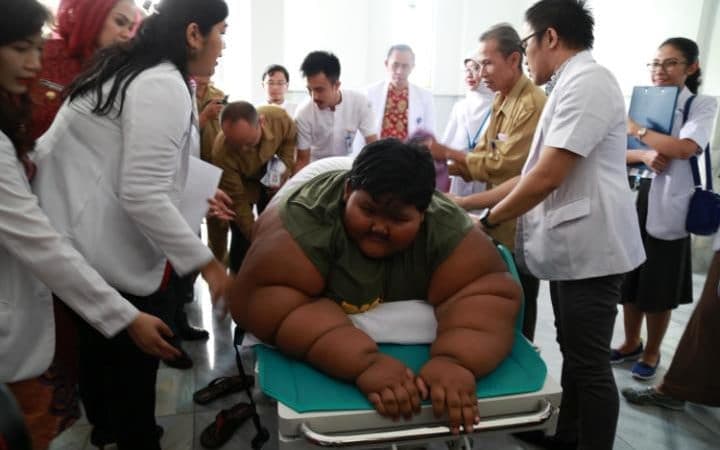 Indoneziyalik 11 yoshli bolaning vazni 192 kilogrammga yetdi
