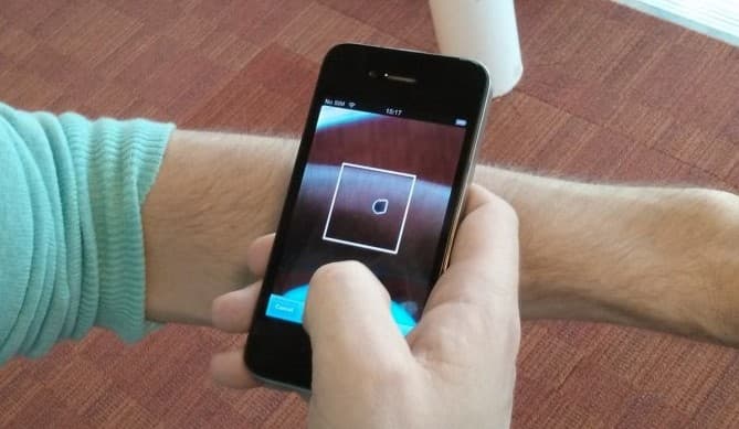 Smartfon yordamida teri saratonini aniqlaydigan algoritm ishlab chiqildi