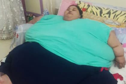 Hindiston hukumati vazni 500 kilogramm bo‘lgan misrlik ayolga yordam beradi
