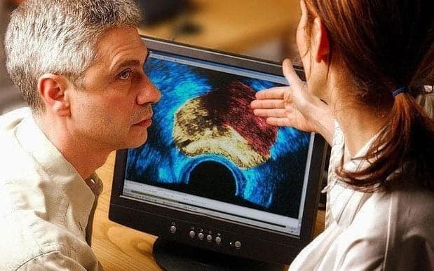 Onkologlar prostata saratonini davolashda katta natijaga erishdilar