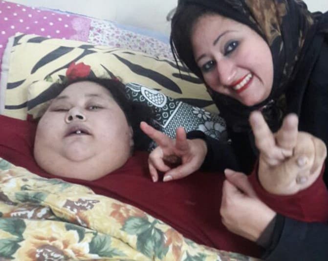 Dunyodagi eng og‘ir vaznli ayol 140 kilogrammga ozdi