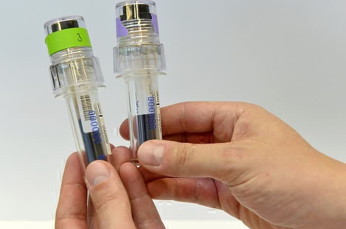 Olimpiya o‘yinlarida ishtirok etgan 182 nafar sportchining doping namunasi ijobiy natija berdi