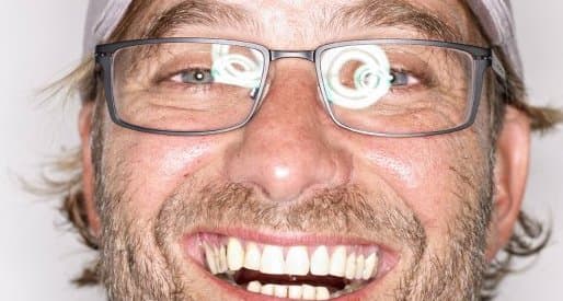 Klopp nursiz durangdan ham ijobiy jihat topa oldi