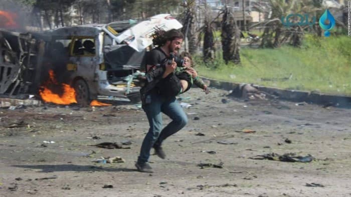 Suriyalik fotosuratchi portlash sabab yaralangan bolani qutqarish uchun suratga olishni to‘xtatdi
