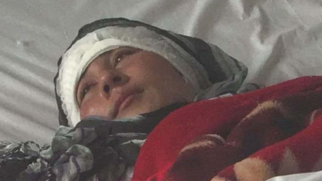 Rashkchi erkak yosh xotinining ikki qulog‘ini kesib tashladi