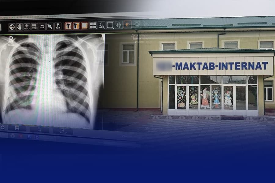 Silga moyil bolalar oddiy maktab o‘quvchilariga qo‘shib yuborilmoqda. Ota-onalar xavotirda