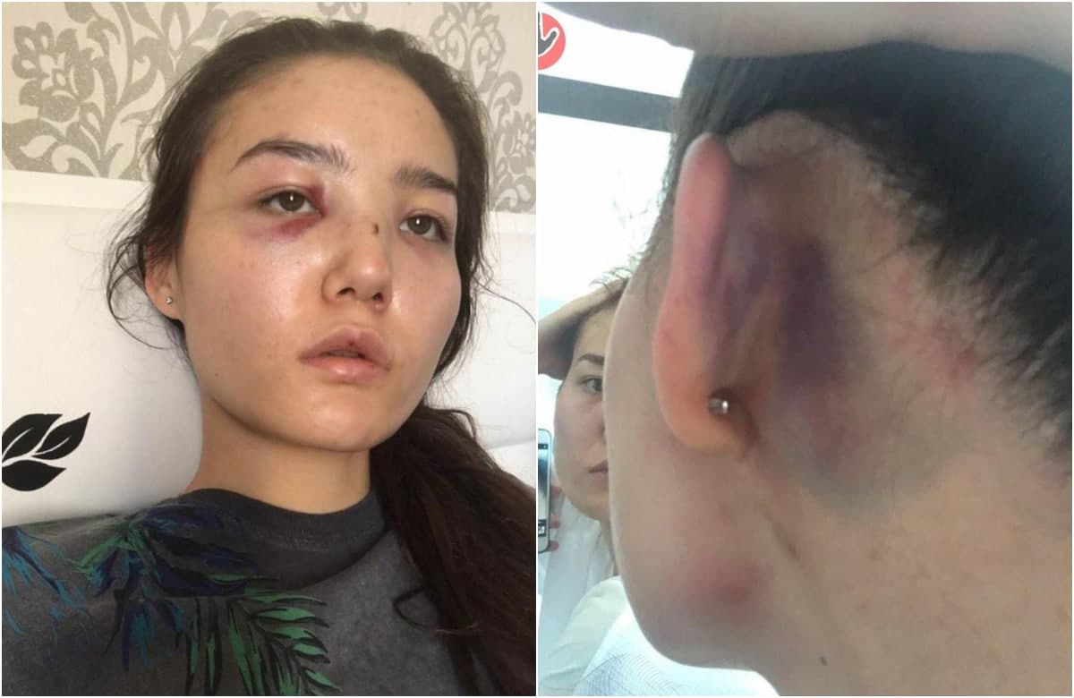 Qozog‘istonlik diplomatning xotini muntazam zo‘ravonlikka uchrayotgani haqida xabar berdi