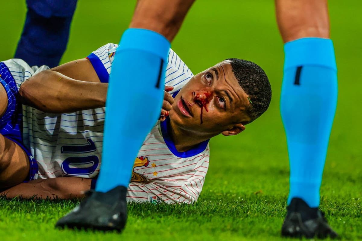 Mbappe guruh bosqichining qolgan o‘yinlarini o‘tkazib yuboradi. Bu Fransiyaga muammo tug‘diradimi?