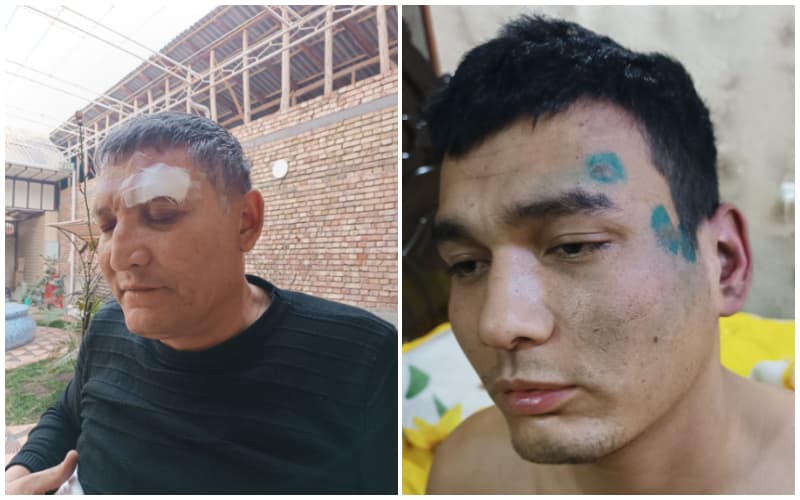 Фарғонада ота ва ўғил ички ишлар органи ходимлари томонидан калтакланди. Прокуратура ҳолатни текширмоқда