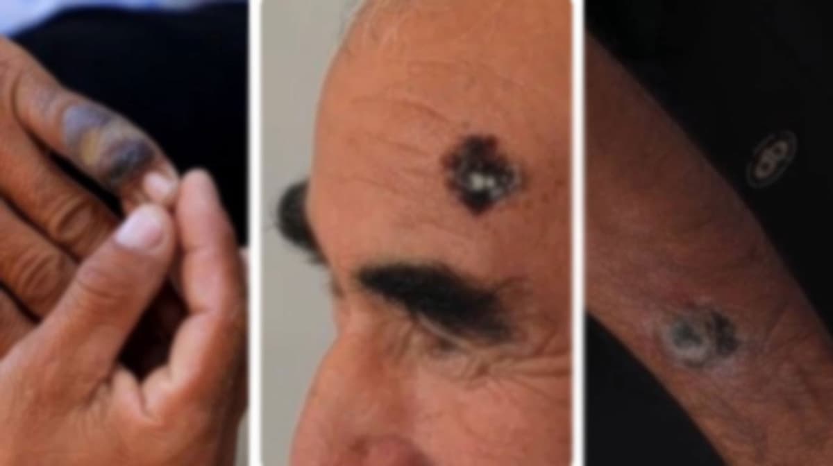 Jizzaxda ikki kishi kuydirgiga chalinganlikda gumonlanayotganlik holatiga izoh berildi