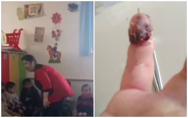 Болаларнинг юзига бир неча бор тарсаки туширган боғча тарбиячисига нисбатан терговга қадар текширув бошланди