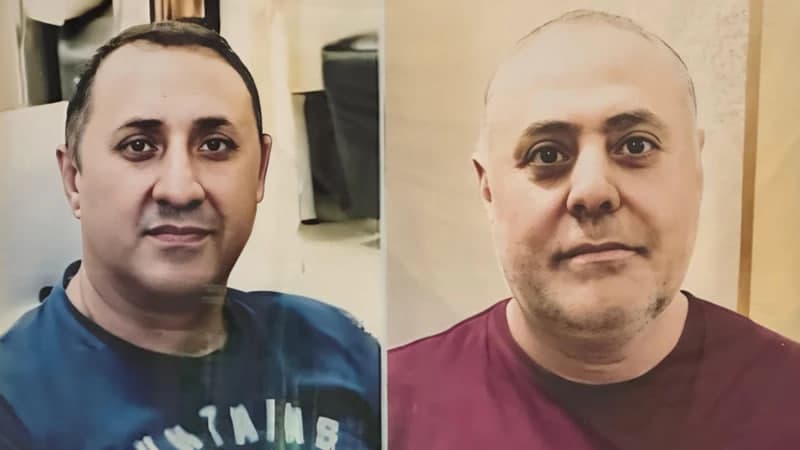 Moskva va Boku o‘rtasida nizo davom etmoqda
