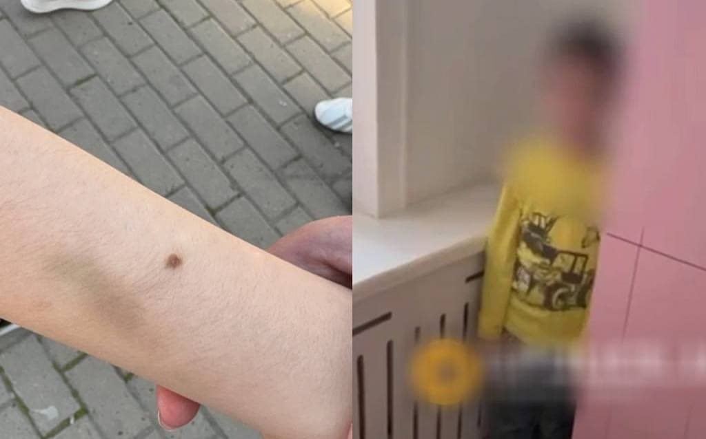 Toshkentda kamera yo‘q xonada bolani urgan bog‘cha xodimi ishdan olindi