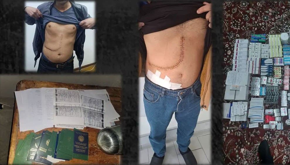 Inson organlari savdosi bilan shug‘ullangan uyushgan jinoiy guruhga hukm o‘qildi