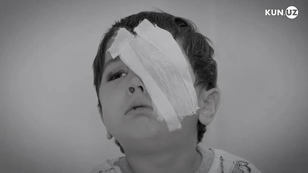 Hamdardlik: Oqqon dardidan shifo topishi uchun xayriya aksiyasi tashkil qilingan Boburjon vafot etdi