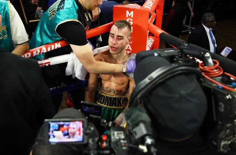 Bokschi Dadashev og‘ir jarohatdan vafot etdi – jangni to‘xtatishga uni zo‘rg‘a ko‘ndirishgan edi