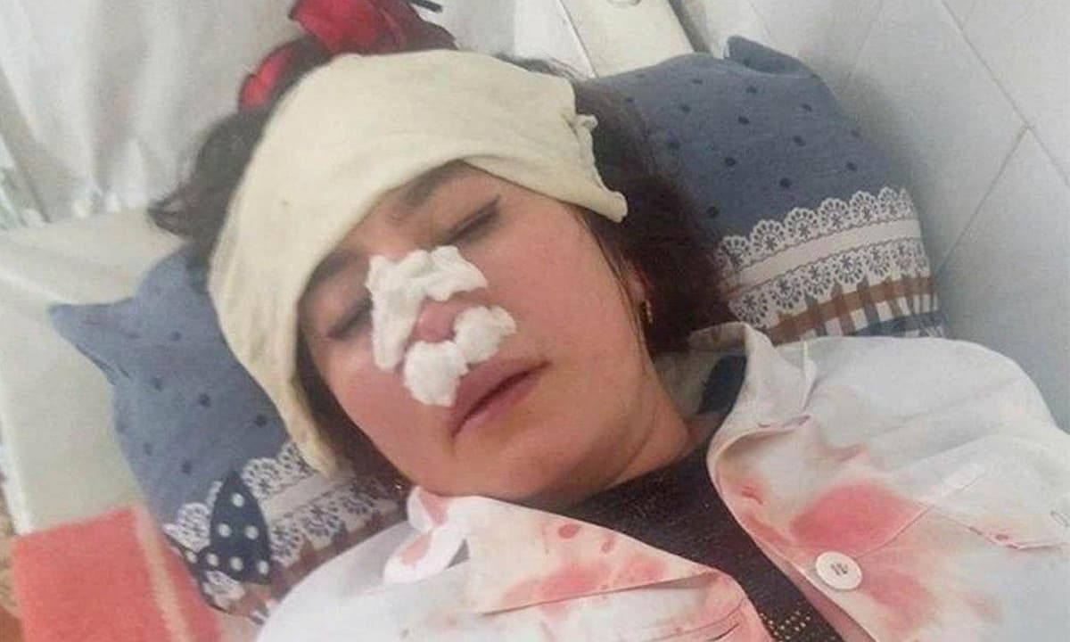 Foto: Farg‘onada bemor va onasi tibbiyot xodimlariga hujum qildi