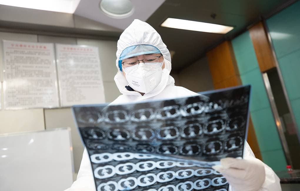 Xitoyda koronavirus qurbonlari soni 1000dan oshdi