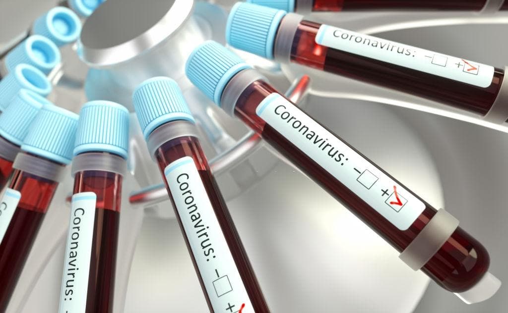 Количество зараженных коронавирусом достигло 23 человек