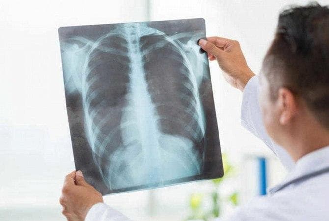 Виды пневмонии, медицинская статистика и критерий сезонности – беседа с экспертом