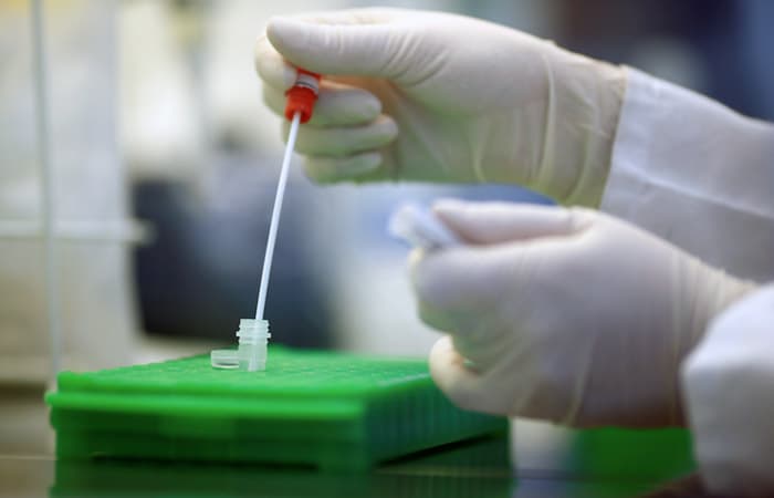 Koronavirus Tojikistonda. Vazirlik zararlanish holatlarini rasman tasdiqladi