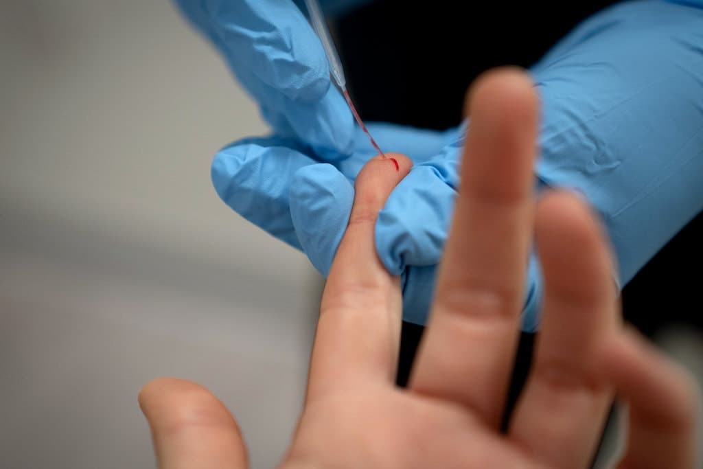 Serologik testlar: ular insoniyatga izolyatsiyadan chiqishga yordam beradimi?