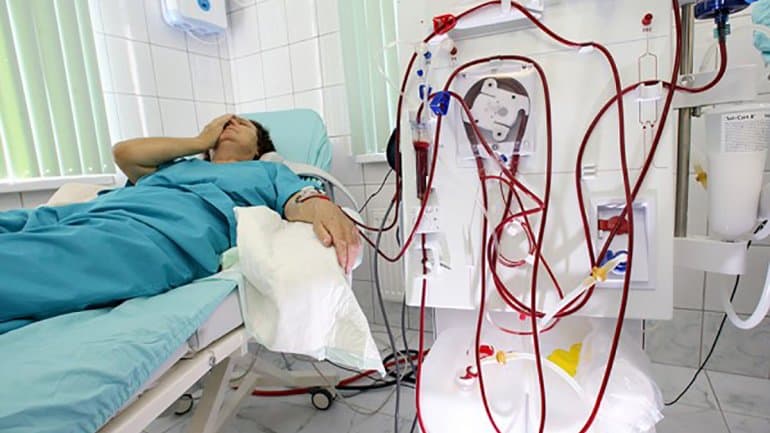 5 mingdan ortiq bemor ilk bor bepul gemodializ xizmati bilan qamrab olinadi