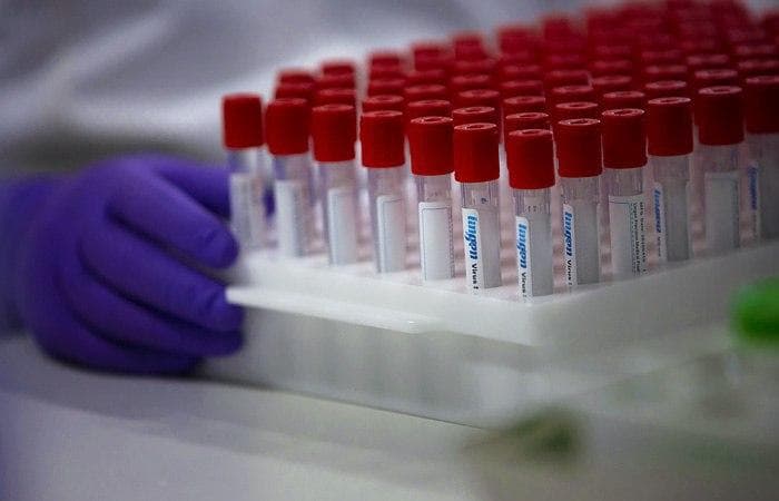 O‘zbekistonda kuz faslida koronavirus pandemiyasining ikkinchi to‘lqini kutilyaptimi? – mutaxassis izohi