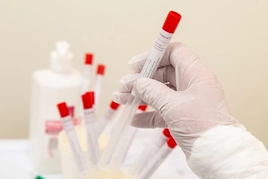 Tailandga keluvchi xorijliklarga koronavirusga 96 dollarlik test topshirish majburiy qilindi