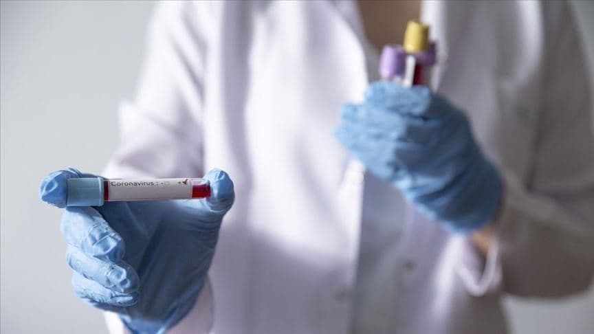 O‘zbekistonda koronavirus infeksiyasi bilan kasallanganlar soni 55 nafarga yetdi