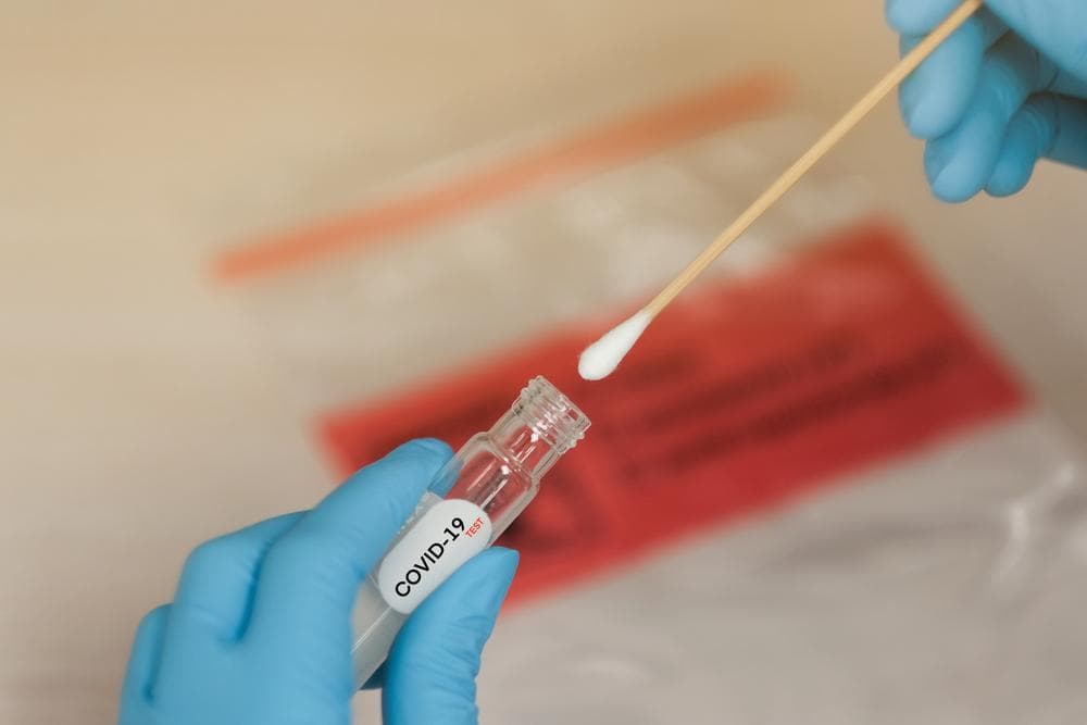 Belgiyalik olimlar koronavirusni 15 daqiqada aniqlaydigan test ishlab chiqdi