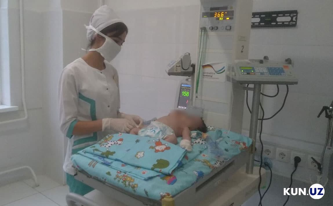 Samarqandda tug‘ilgan siam egizaklari vafot etdi