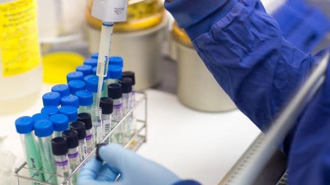 Qirg‘iziston hukumatining 26 xodimida koronavirus aniqlandi