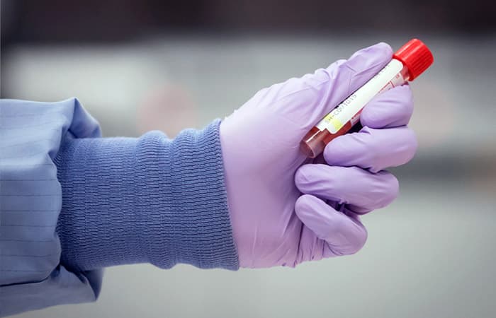 Узбекистан прошёл пик количества болеющих COVID-19 неделю назад