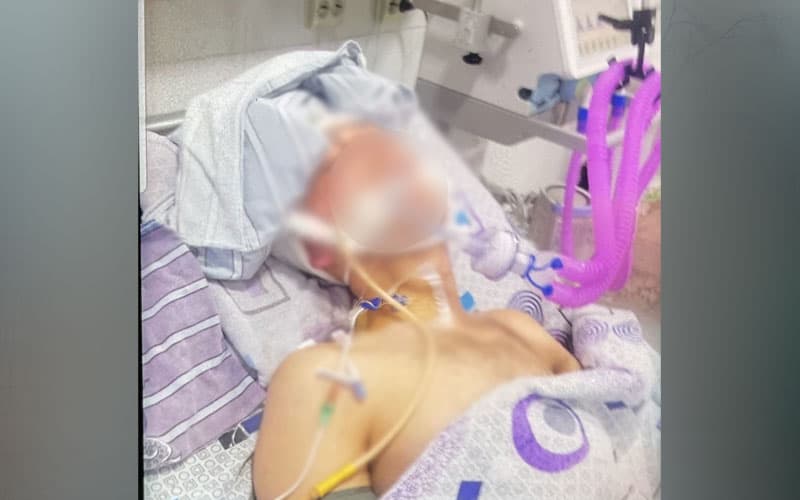 San'at instituti talabasi 5 kundan beri komada. Kursdoşlar janjali jiddiy oqibatga olib keldi