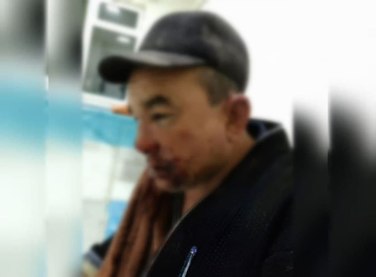 Qashqadaryoda bir guruh shaxslar aka-ukalarni kaltaklagani, ularga deputat bosh bo‘lgani aytilmoqda