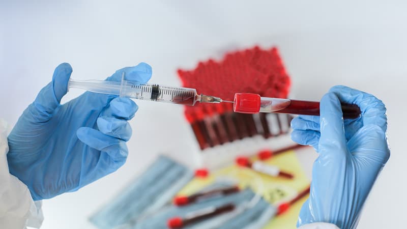 “Britancha” shtammni aniqlovchi ilk test-tizim ishlab chiqildi