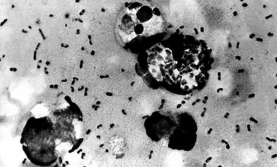 No black plague is posing threat to Uzbekistan – Health Service