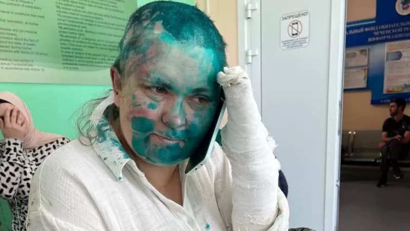 Chechenistonda jurnalist ayolga hujum qilindi