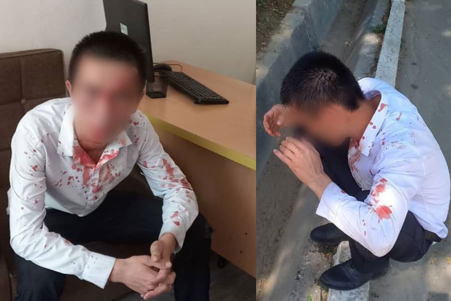 Uchtepada o‘qituvchi o‘quvchisining yaqinlari tomonidan kaltaklandi. Janjalda maktab mulkiga ham zarar yetkazilgan