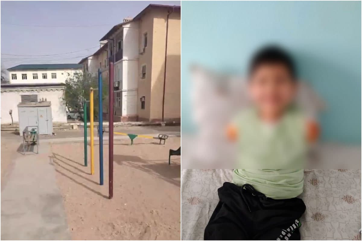 Navoiyda 6 yoshli bola tok urishi oqibatida ikki qo‘lidan ayrildi