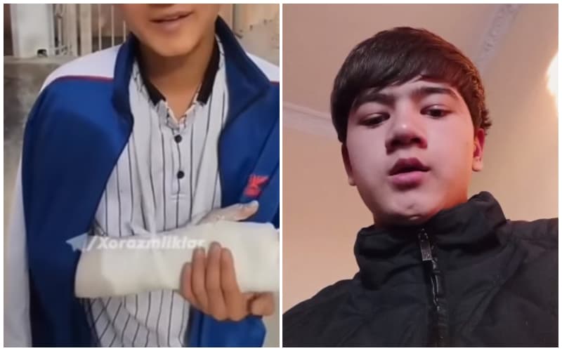 «Prank» video uchun shifokorlarni aldab sog‘lom qo‘lini gips qildirgan o‘smir uzr so‘rab chiqdi