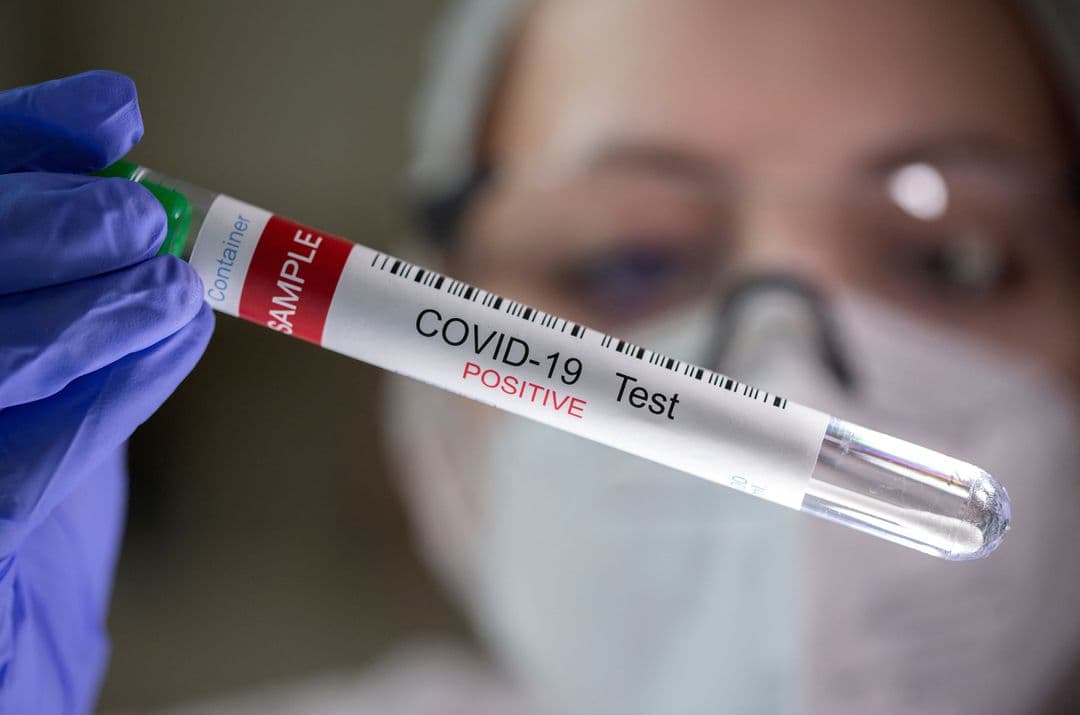 Қўшма Штатларда COVID-19 келиб чиқиши ҳақидаги саволга аниқ жавоб йўқ — Блинкен 