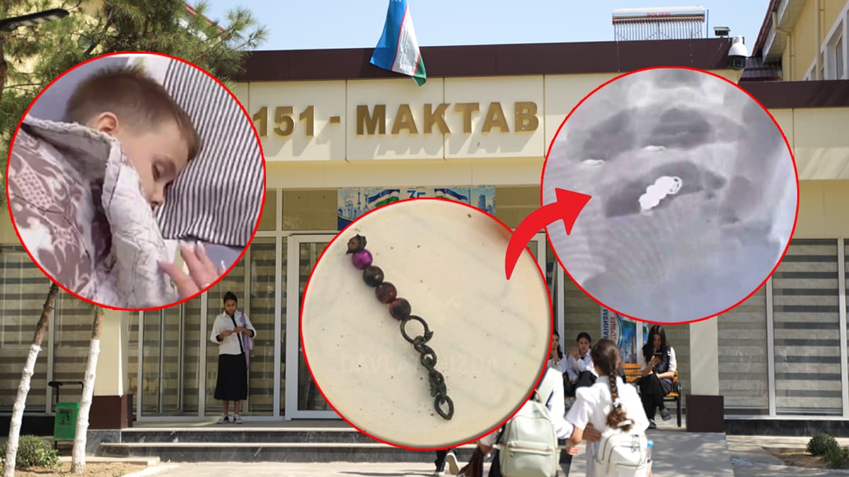 Темир билагузук ютган ўқувчи: 151-мактабда нима бўлган?