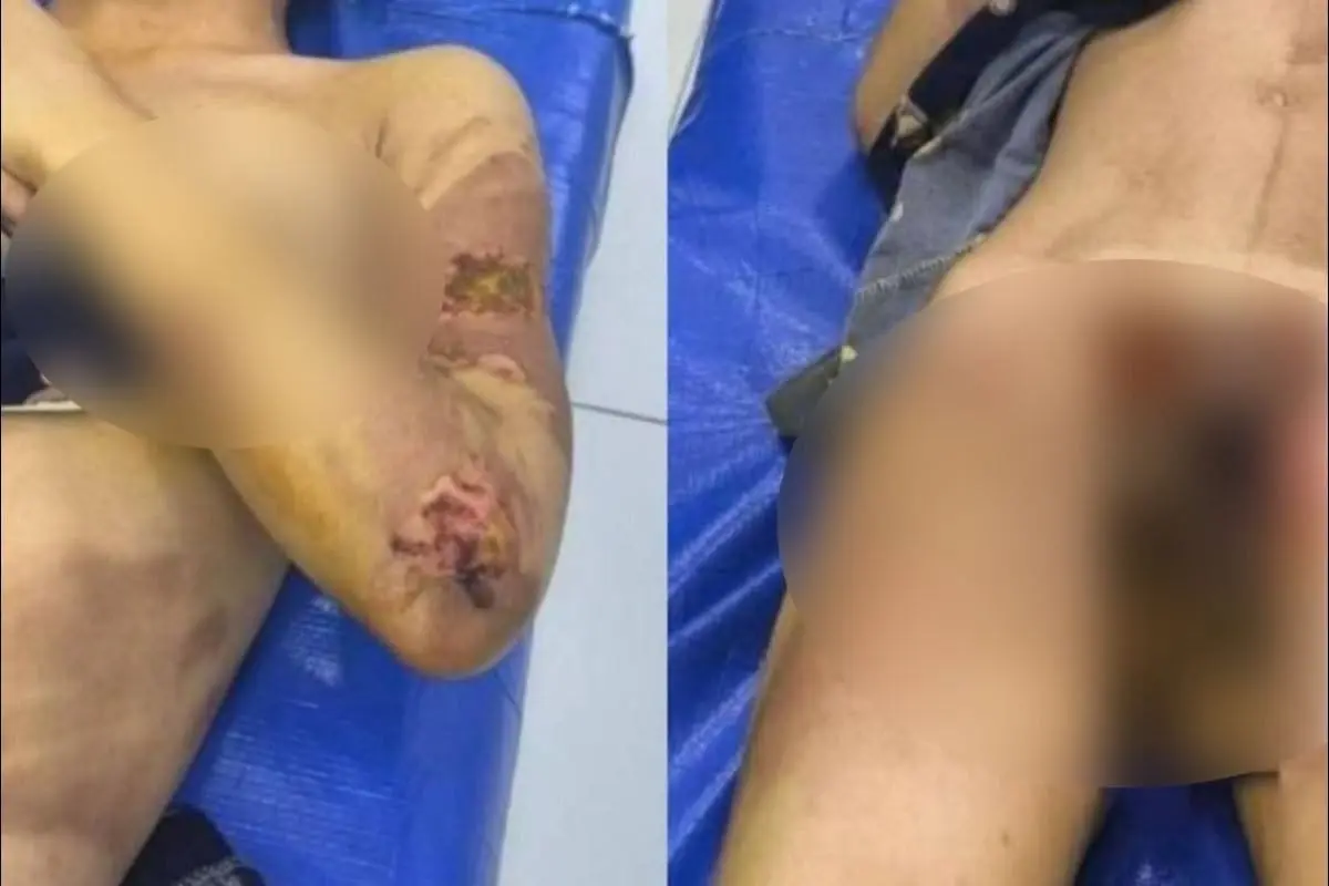 Jizzaxda kelinga tarakan dorisi yedirilib, hojatxona suvini ichishga majburlandi