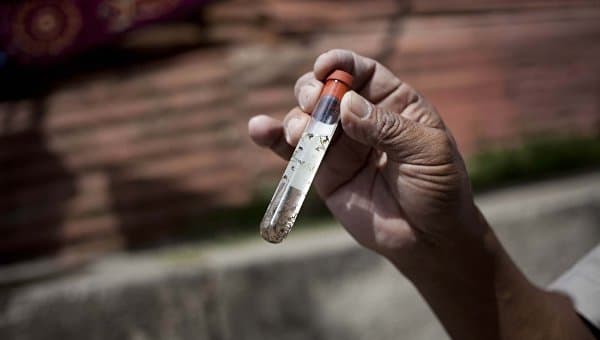Hindistonning 13 fuqarosi Singapurda Zika virusiga chalindi