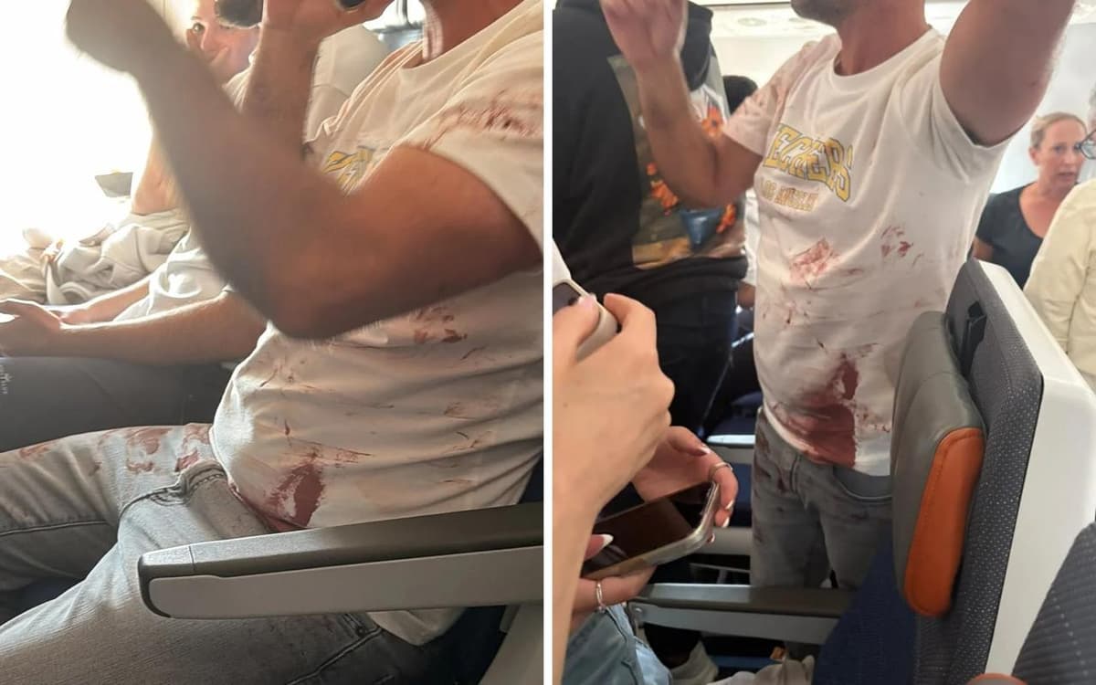 Dubaydan Tel-Avivga uchgan samolyotda favqulodda holat roʻy berdi