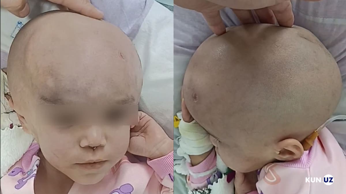 Фарғонада боланинг ҳаётини хавф остида қолдирган энага устидан жиноят иши қўзғатилди