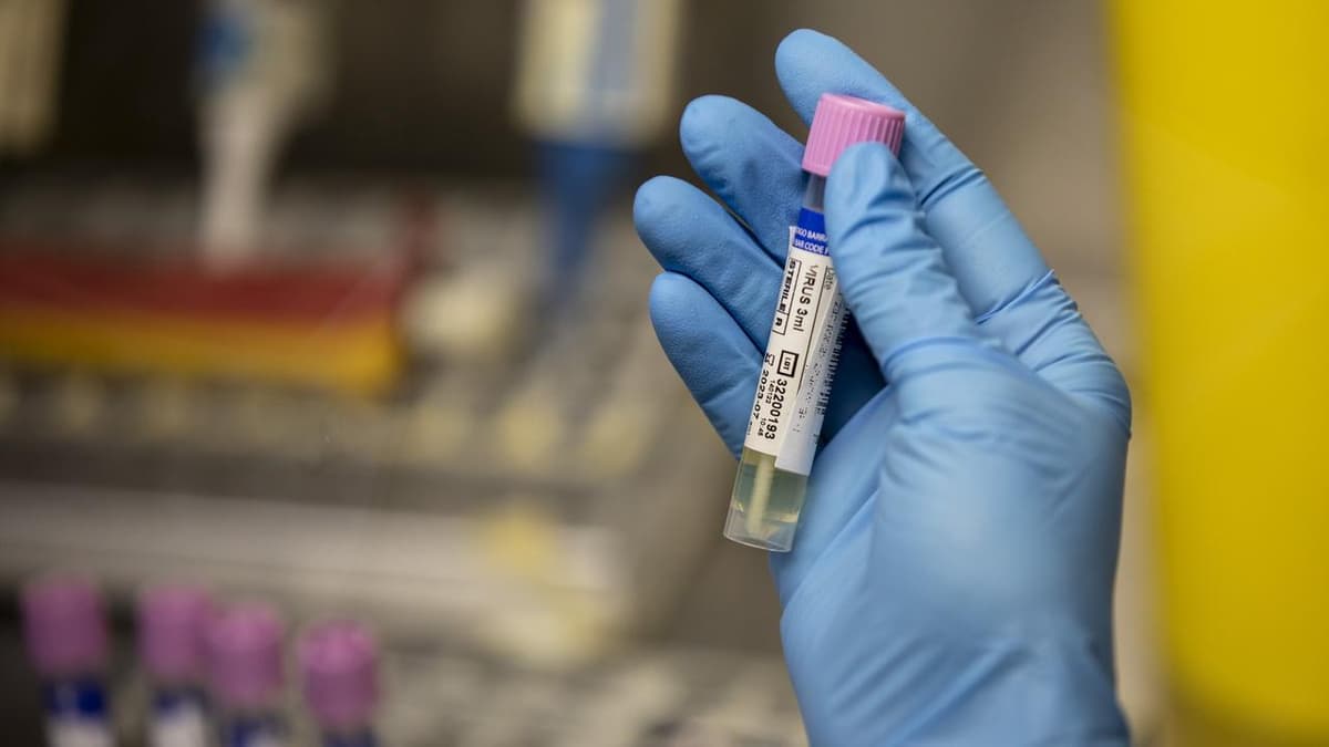 Avstraliyadagi laboratoriyada o‘limga olib keluvchi viruslar solingan yuzlab flakonlar yo‘qoldi